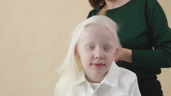 Charming Little Model Albino Is Preparing for a Photo in the Studio