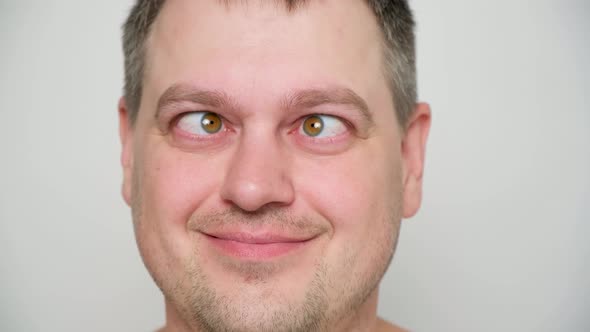 A Man with Strabismus Squints His Eyes on a White Background