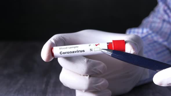 Laboratory Technician Hand Holding Blood Test Tube 