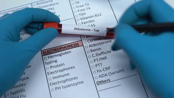 Aldosterone, Doctor Checking Hormone in Lab Blank, Showing Blood Sample in Tube