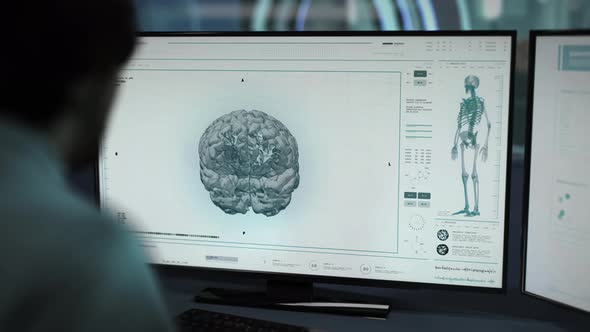 Health Care Diagnostic Interface Analyzing Brain Organ With X-Ray Scanner