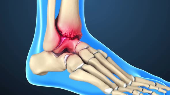 Ankle Joint Anatomy and articular cartilage
