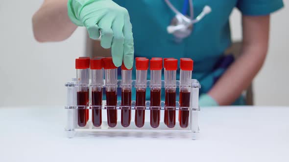 Doctor Nurse Woman Wearing Protective Mask and Latex Gloves - Working with Blood Test Tube Rack