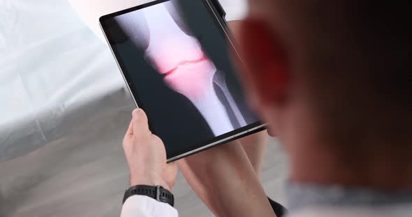 Doctor Makes Xray Image of Patient Sore Knee Joint  Movie