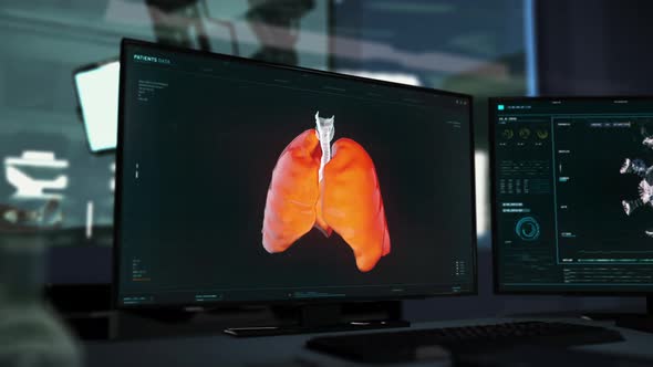 Performing the Analysis of the Patient`s Lungs and Detecting the Covid 19 Virus alt