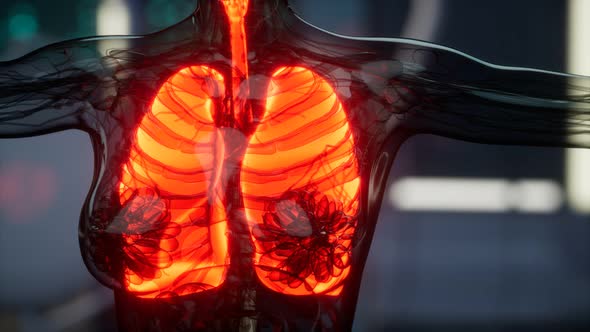 Human Lungs Radiology Exam in Laboratory