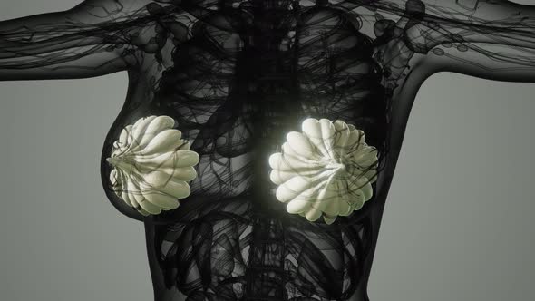 Medical Scan of Woman Breast Cancer alt