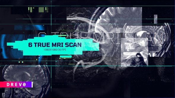 6 in 1 True Mri Scan/ Head X Ray/MRI/ SCULL/ Roentgen/ Face ID/ Medical HUD/ Brain/ Technology