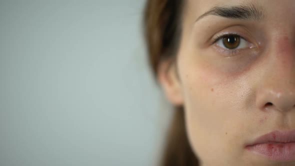 Frightened Bruised Woman Uncertainly Looking at Camera, Scared Violence Victim