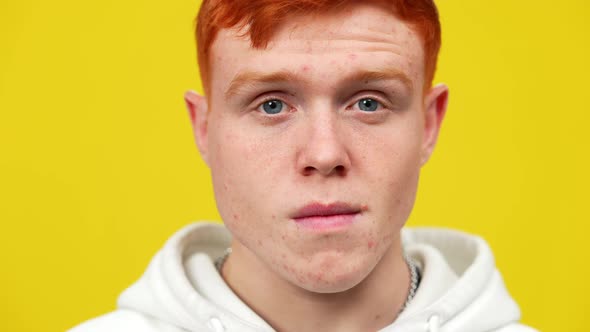 Closeup Face of Young Redhead Man with Problematic Skin Posing at Yellow Background