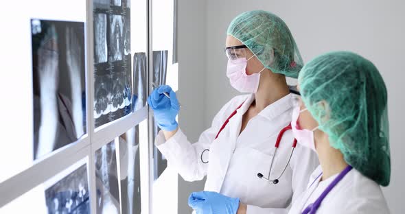 Two Doctors Wearing Protective Masks and Goggles are Study Xrays