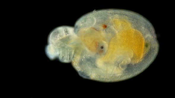 a Worm Larva Under a Microscope, at the Stage of Pelagosphaera, Phylum Sipuncula, Clade