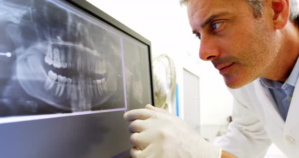 Thoughtful dentist examining an x-ray on the monitor