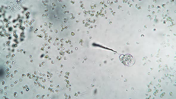 The Infusoria Vorticella Shrinks Sharply and Then Begins to Float