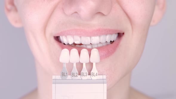 Perfect White Teeth Close Up with Shade Guide Bleach Color Female Veneer Smile Dental Care and