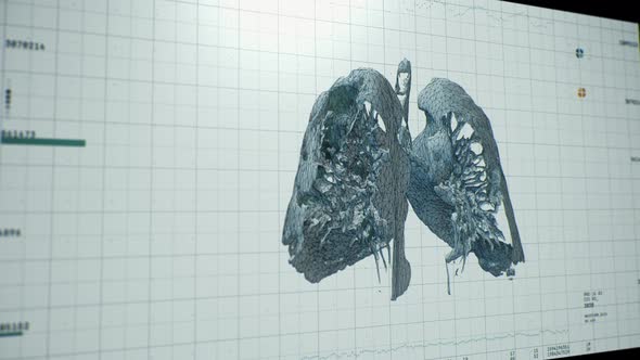 Modern medical research. Creation of 3D model of pneumonia. X-ray image.COVID-19 alt