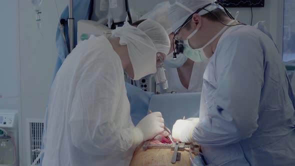 Medical Staff of the Operating Unit Do Heart Surgery