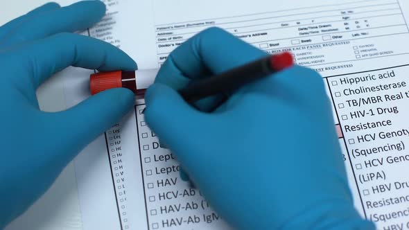 Dengue, Doctor Checking Disease in Lab Blank, Showing Blood Sample in Tube