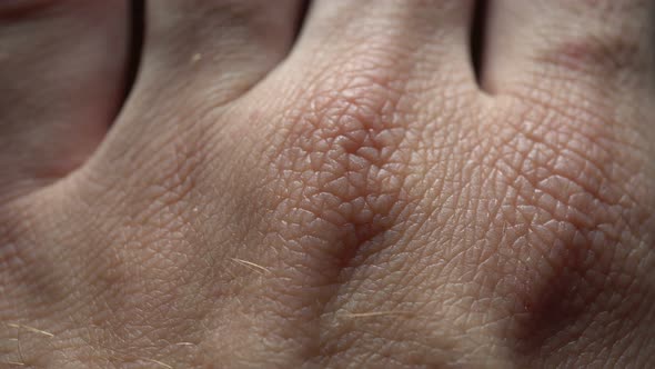 Macro Human Skin Background