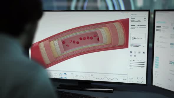 Anatomical Scanner Software Used To Study Biology Of Blood In Human Artery alt
