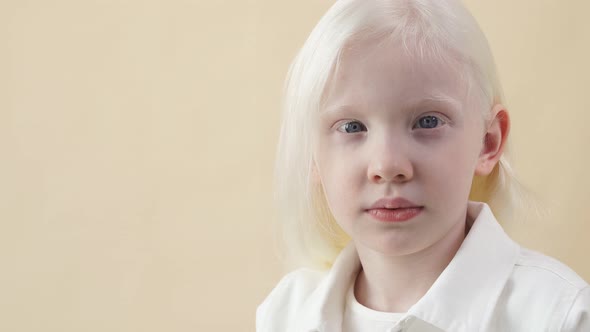 Portrait of Little Girl with Albinism Syndrome.