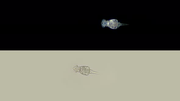 Rotifers Squatinella Sp. Under a Microscope, of the Family Lepadellidae