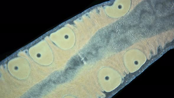 Worm Nemertea Prostoma sp. under microscope, of Tetrastemmatidae family