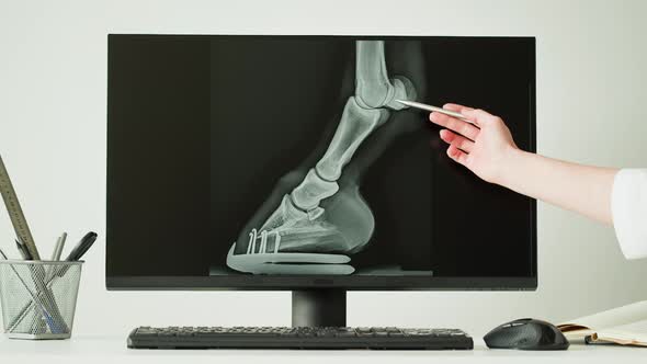 Doctor Veterinarian Examining Horse Leg Skeleton Roentgen on Computer Monitor