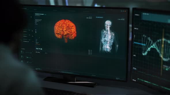 Futuristic Medical MRT Software For Diagnostic Of The Tumors Of A Patient alt