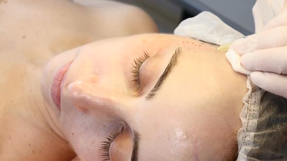 Anti-aging Skin Procedure: Professional Cosmetologist Makes Multiple Facial Injections Leaving