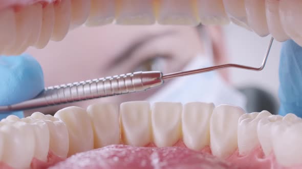 Dentist Making a Tooth Filling with Probe