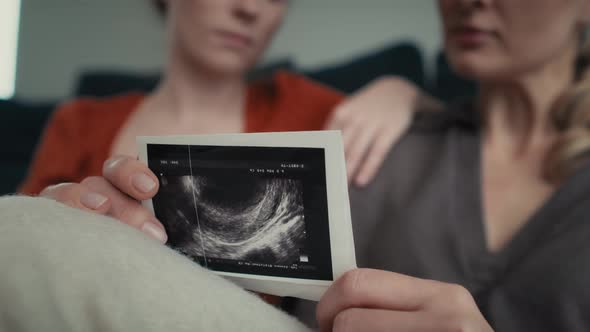 Hand holding ultrasound scan and two women in the background. Shot with RED helium camera in 8K.