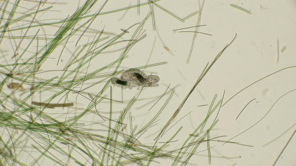  Large and Small Water Bear Tardigrada