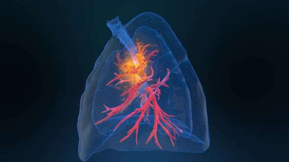 Lung Cancer 3d Render Looping 