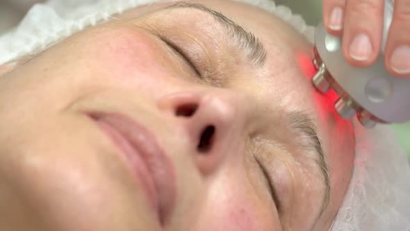 Rf Skin Tightening Close Up