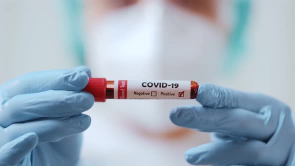 Close Up of Doctor Shows Test Tube with Blood Tested Positive for Covid-19