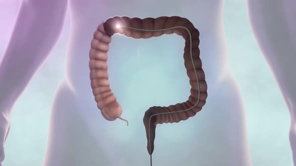 Digestive system- Sigmoid colon, Descending colon alt