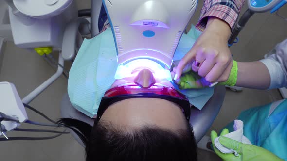 Young Woman with an Expander in Mouth and Red Protective Glasses Getting UV Whitening at the Dentist