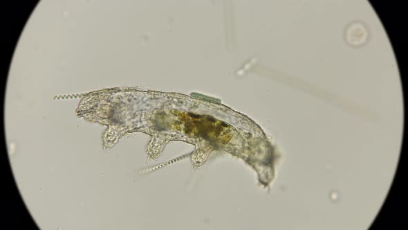 Carcass of a Dead Water Bear Tardigrada