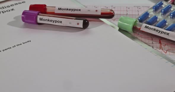 Blood Sample with Monkeypox Smallpox Syndrome Infection Blood Test in Laboratory