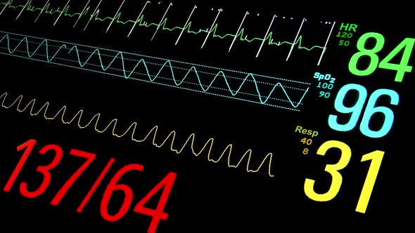 Patient Monitor in ICU