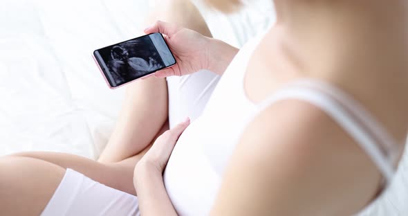 Pregnant Woman Looks Into Smartphone at Ultrasound of Child