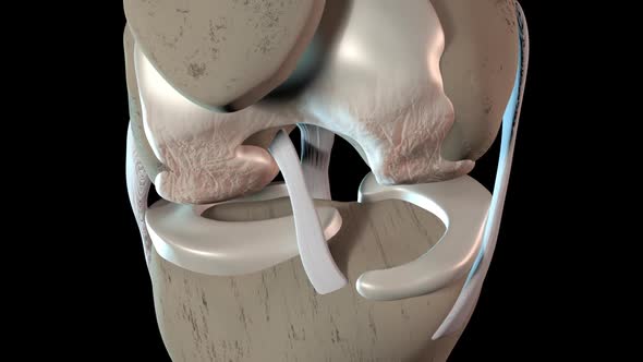 Damage To The Knee Cartilage Tissue