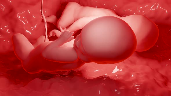 twins in the womb, Monozygotic twins in uterus with single placenta, Human twin