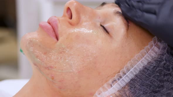 Close-up, Cosmetologist in Black Medical Gloves Applies Cosmetic Gel To Female Face with Massage