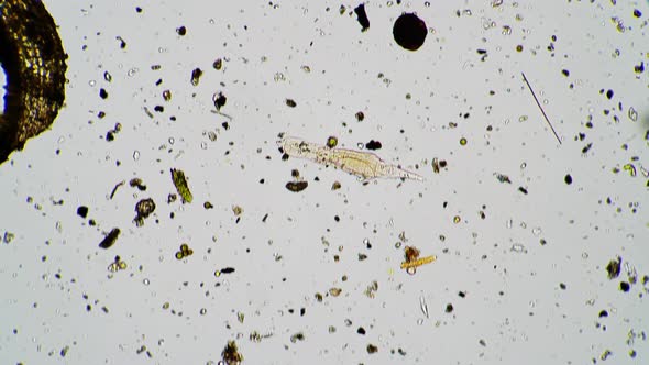 The Rotifer Moves in Fresh Water Under a Microscope