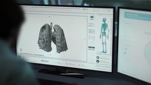 Medical Scan Interface Analyzing Patients Breast To Diagnose Covid In Lungs