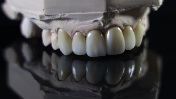 Dental health care. Close up ceramic zirconium. Dental prosthesis on zirconium oxide implants