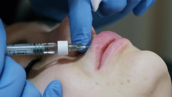 Closeup of Hands of Cosmetologist Making Injection in Female Lips