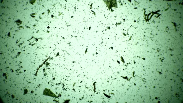 Moving a Large Number of Infusoria and Microorganisms Microcosmic Timelapse